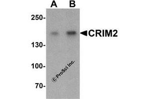 Western Blotting (WB) image for anti-Kielin/Chordin-Like Protein (KCP) (C-Term) antibody (ABIN1030344) (KCP Antikörper  (C-Term))