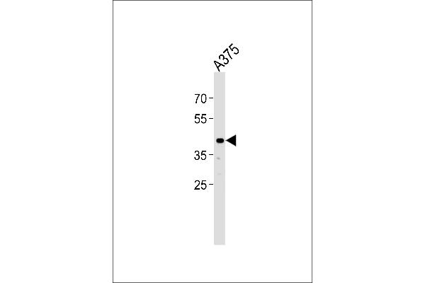 SIRPB1 Antikörper  (N-Term)