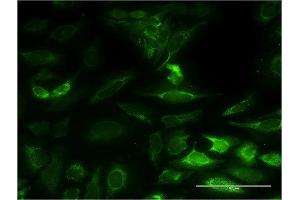 Immunofluorescence of monoclonal antibody to NT5M on HeLa cell.