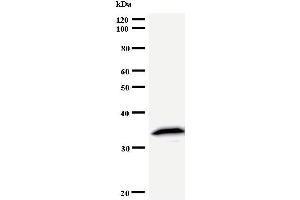 Western Blotting (WB) image for anti-Tyrosyl-tRNA Synthetase (Yars) antibody (ABIN933090)