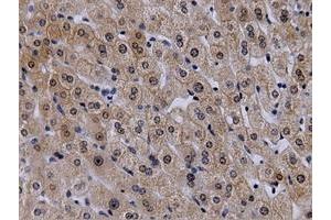 Immunohistochemical staining of paraffin-embedded Human liver tissue using anti-VWA5A mouse monoclonal antibody. (VWA5A Antikörper)