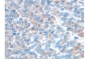 Detection of SNAP23 in Mouse Stomach Tissue using Polyclonal Antibody to Synaptosomal Associated Protein 23 kDa (SNAP23)