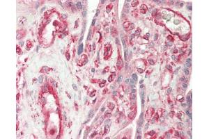 Immunohistochemistry (Paraffin-embedded Sections) (IHC (p)) image for anti-Collagen, Type IV, alpha 1 (COL4A1) antibody (HRP) (ABIN2595853)
