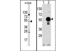 (LEFT)Western blot analysis of anti-AKT2 Antibody (N-term) Pab in mouse liver tissue lysates (35ug/lane). (AKT2 Antikörper  (N-Term))
