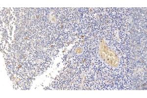 Detection of SDC1 in Human Tonsil Tissue using Monoclonal Antibody to Syndecan 1 (SDC1) (Syndecan 1 Antikörper  (AA 23-253))