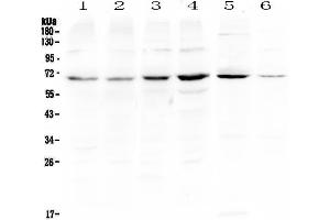 Western blot analysis of PIAS3 using anti-PIAS3 antibody .