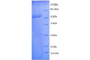 SDS-PAGE (SDS) image for Transgelin (TAGLN) (AA 2-201), (full length) protein (GST tag) (ABIN7479164)