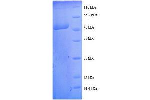 Transgelin (TAGLN) (AA 2-201), (full length) protein (GST tag)