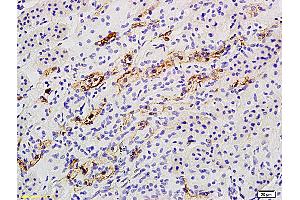 Formalin-fixed and paraffin embedded rat kidney labeled with Anti Catalase Polyclonal Antibody, Unconjugated (ABIN872991) followed by conjugation to the secondary antibody and DAB staining