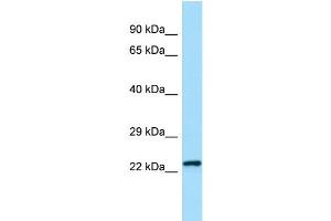 WB Suggested Anti-Chmp2b Antibody Titration: 1.