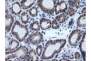 Image no. 3 for anti-Aryl Hydrocarbon Receptor Interacting Protein-Like 1 (AIPL1) antibody (ABIN1496508) (AIPL1 Antikörper)