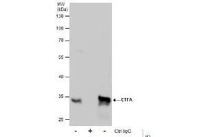 IP Image Immunoprecipitation of ETFA protein from HepG2 whole cell extracts using 5 μg of ETFA antibody, Western blot analysis was performed using ETFA antibody, EasyBlot anti-Rabbit IgG  was used as a secondary reagent. (ETFA Antikörper  (Center))