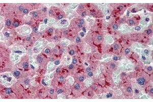 Detection of ABCB11 in Human Liver Tissue using Polyclonal Antibody to ATP Binding Cassette Transporter B11 (ABCB11) (ABCB11 Antikörper  (AA 421-663))