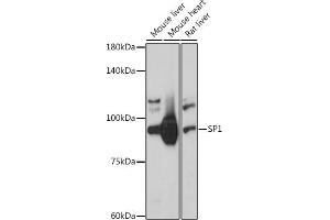 Western blot analysis of extracts of various cell lines, using SP1 antibody (ABIN7270506) at 1:1000 dilution. (SP1 Antikörper  (AA 420-620))