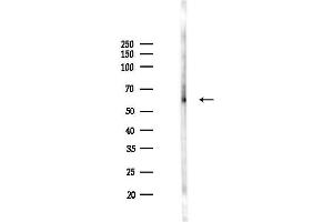 anti-Interleukin 21 Receptor (IL21R) (Internal Region) antibody