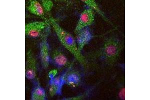 Tau-stable SY5Y cell image stained for endogenous LRRK (green) by Abgent L955a (affinity purified), phosphorylated tau (red, monoclonal AT8) and nuclear staining by DI. (LRRK2 Antikörper  (AA 930-961))