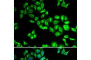 Immunofluorescence analysis of HeLa cells using CUL1 Polyclonal Antibody (Cullin 1 Antikörper)