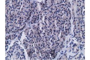 Immunohistochemical staining of paraffin-embedded Carcinoma of Human kidney tissue using anti-CD80 mouse monoclonal antibody. (CD80 Antikörper)