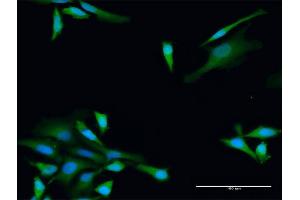 Immunofluorescence of purified MaxPab antibody to ADH5 on HeLa cell.
