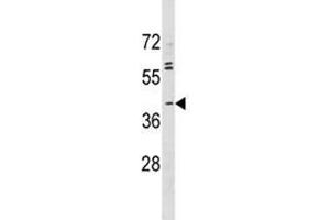 ABO antibody western blot analysis in MDA-MB231 lysate (ABO Antikörper  (AA 41-68))