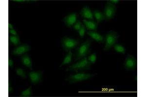 Immunofluorescence of monoclonal antibody to OXSR1 on HeLa cell. (OXSR1 Antikörper  (AA 1-527))