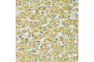 Immunohistochemistry (Paraffin-embedded Sections) (IHC (p)) image for anti-Heat Shock 70kDa Protein 9 (Mortalin) (HSPA9) (AA 380-679) antibody (ABIN3021000)