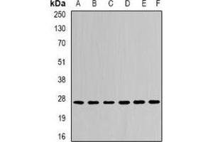 Western blot analysis of CDC34B expression in Jurkat (A), MCF7 (B), mouse liver (C), mouse kidney (D), rat brain (E), rat lung (F) whole cell lysates. (UBE2R2 Antikörper)