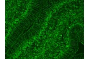 Cerebellum immunofluorescence.