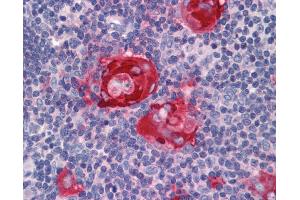 Anti-ZFP36 antibody IHC of human thymus. (ZFP36 Antikörper  (AA 41-90))