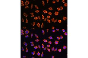 Immunofluorescence analysis of L929 cells using NOTCH3 Rabbit pAb (ABIN1681077, ABIN3015390, ABIN3015391 and ABIN6214032) at dilution of 1:100. (NOTCH3 Antikörper  (AA 751-850))