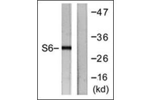 Western blot analysis of extracts from HeLa cells, treated with TNF-a 20ng/ml 2', using. (RPS6 Antikörper  (C-Term))