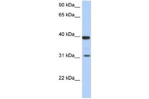 WB Suggested Anti-RPSA Antibody Titration: 0. (RPSA/Laminin Receptor Antikörper  (Middle Region))