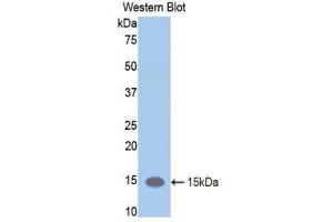 Western Blotting (WB) image for anti-Leukemia Inhibitory Factor Receptor alpha (LIFR) (AA 381-485) antibody (ABIN1859656)