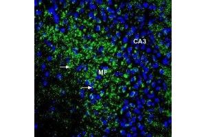 Immunohistochemistry (IHC) image for anti-Solute Carrier Family 39 (Zinc Transporter), Member 1 (SLC39A1) (AA 5-20), (Extracellular) antibody (ABIN7043723)