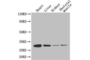 Western Blot Positive WB detected in: Mouse heart tissue, Mouse liver tissue, Mouse kidney tissue, Mouse skeletal muscle tissue All lanes: ADIPOQ antibody at 4 μg/mL Secondary Goat polyclonal to rabbit IgG at 1/50000 dilution Predicted band size: 27 kDa Observed band size: 27 kDa (ADIPOQ Antikörper  (AA 19-244))