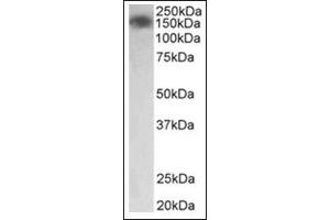 Staining of Human Colon lysate (35µg protein in RIPA buffer) using MYLK antibody at0. (MYLK Antikörper  (Internal Region))