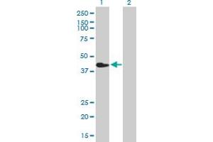 Western Blot analysis of CHIA expression in transfected 293T cell line by CHIA MaxPab polyclonal antibody. (CHIA Antikörper  (AA 1-368))