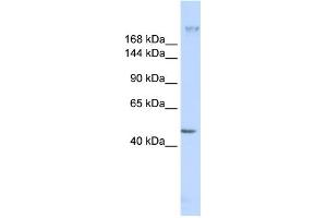 WB Suggested Anti-FER1L3 Antibody Titration:  0.