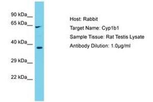 Image no. 1 for anti-Cytochrome P450, Family 1, Subfamily B, Polypeptide 1 (CYP1B1) (AA 294-343) antibody (ABIN6750328) (CYP1B1 Antikörper  (AA 294-343))
