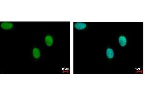 ICC/IF Image DNA ligase III antibody detects LIG3 protein at nucleus by immunofluorescent analysis. (LIG3 Antikörper)