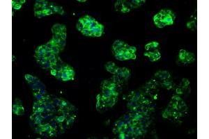 Immunofluorescent staining of HeLa cells using anti-RNF144B mouse monoclonal antibody (ABIN2453607). (RNF144B Antikörper  (AA 1-256))