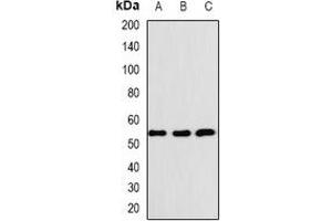 Western blot analysis of BAF57 expression in K562 (A), SHSY5Y (B), SKOV3 (C) whole cell lysates. (SMARCE1 Antikörper)