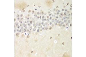Immunohistochemistry of paraffin-embedded mouse brain using Nono Antibody (ABIN5973035) at dilution of 1/100 (40x lens). (NONO Antikörper)