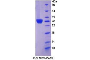 Image no. 1 for Coxsackie Virus and Adenovirus Receptor (CXADR) (AA 20-229) protein (His tag) (ABIN6237585)
