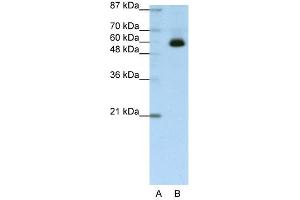 WB Suggested Anti-ZNF307 Antibody Titration:  1. (ZKSCAN4 Antikörper  (C-Term))