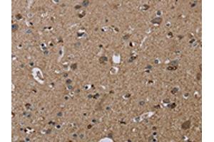The image on the left is immunohistochemistry of paraffin-embedded Human brain tissue using ABIN7192919(TRPM1 Antibody) at dilution 1/20, on the right is treated with synthetic peptide. (TRPM1 Antikörper)