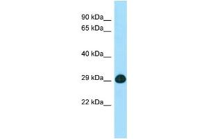 WB Suggested Anti-SLC25A2 Antibody Titration: 1. (SLC25A2 Antikörper  (C-Term))