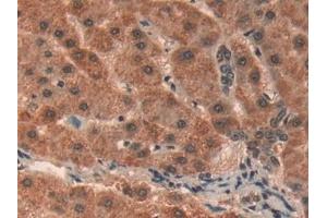 Immunohistochemistry (IHC) image for anti-Prohibitin (PHB) (AA 177-272) antibody (ABIN7431794)
