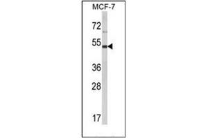 Western blot analysis of LUC7L2 Antibody (C-term) in MCF-7 cell line lysates (35ug/lane). (LUC7L2 Antikörper  (C-Term))
