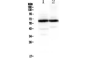 Western blot analysis of Synaptotagmin 1 using anti-Synaptotagmin 1 antibody .